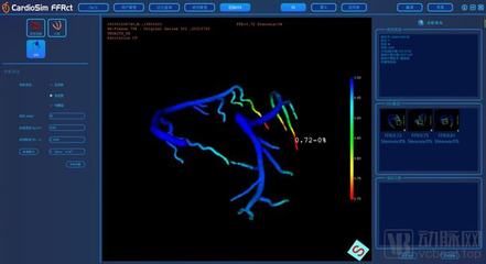 生物流體力學賦能精準醫(yī)療，晟視科技近億元Pre-A輪融資引領超聲技術創(chuàng)新